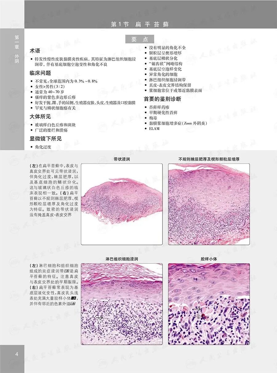 怎么买病理图文遇“荐”好书｜｜一本妇科病理诊断必备案头书：《妇科病理诊断学》_https://www.jmylbn.com_新闻资讯_第10张