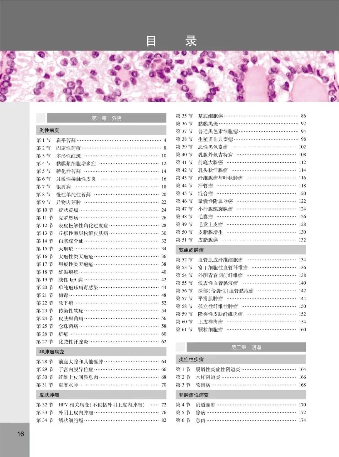 怎么买病理图文遇“荐”好书｜｜一本妇科病理诊断必备案头书：《妇科病理诊断学》_https://www.jmylbn.com_新闻资讯_第6张