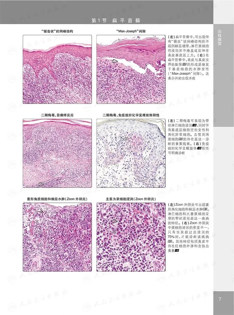 怎么买病理图文遇“荐”好书｜｜一本妇科病理诊断必备案头书：《妇科病理诊断学》_https://www.jmylbn.com_新闻资讯_第13张