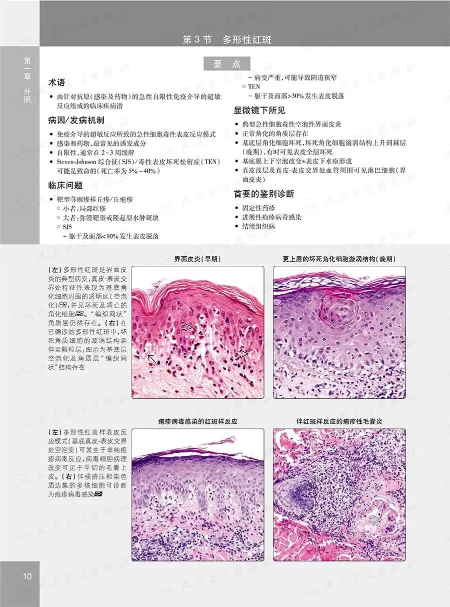 怎么买病理图文遇“荐”好书｜｜一本妇科病理诊断必备案头书：《妇科病理诊断学》_https://www.jmylbn.com_新闻资讯_第16张