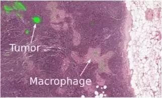 640?wx_fmt=jpeg&tp=webp&wxfrom=5&wx_lazy