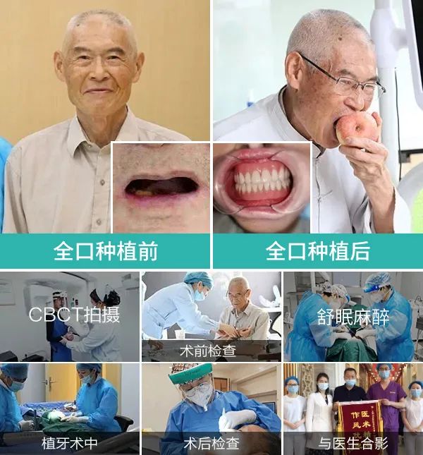 通知:首批百万种植牙、牙齿矫正补贴发放,居民可在线申领!申领入口....-微信头条网 通知:首批百万种植牙、牙齿矫正补贴发放,居民可在线申领!申领入口....