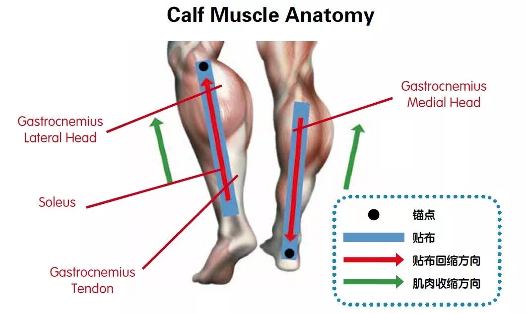 使用肌内效贴前 需要先掌握的知识点 肌内效贴技术 微信公众号文章阅读 Wemp