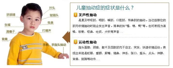 每天学问病——小儿抽动症