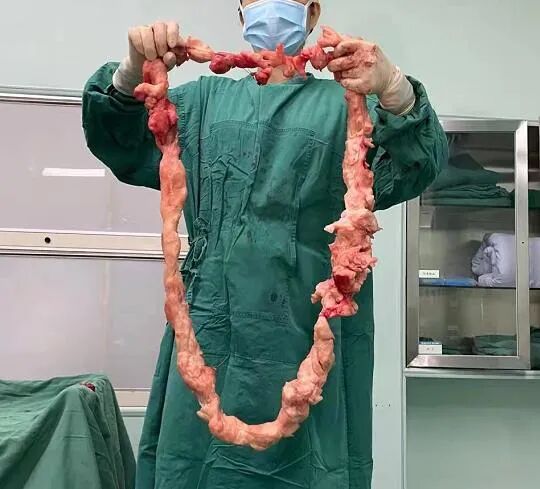 妇科器械盘怎么消毒妇科手术也“医美”_https://www.jmylbn.com_新闻资讯_第25张