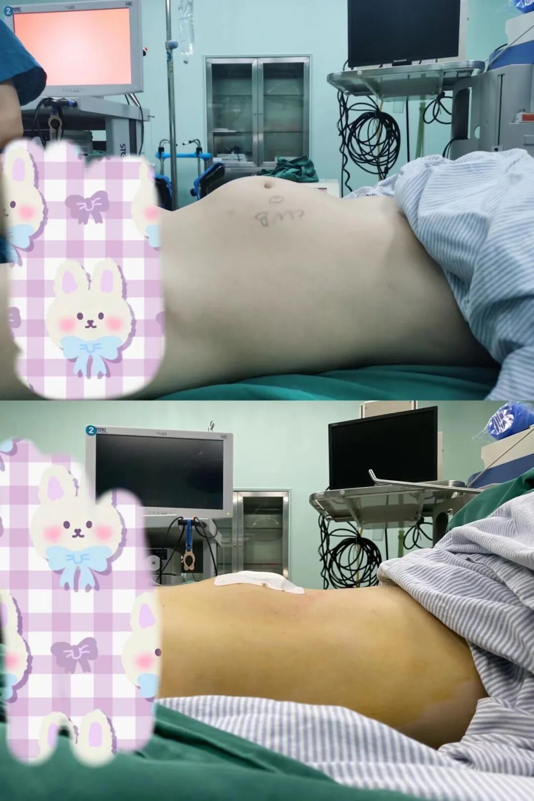 妇科器械盘怎么消毒妇科手术也“医美”_https://www.jmylbn.com_新闻资讯_第23张