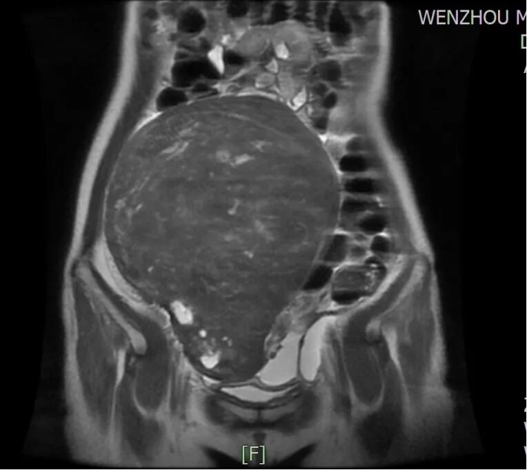 妇科器械盘怎么消毒妇科手术也“医美”_https://www.jmylbn.com_新闻资讯_第20张