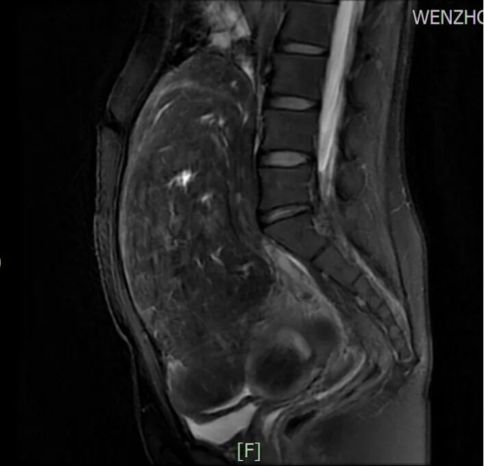妇科器械盘怎么消毒妇科手术也“医美”_https://www.jmylbn.com_新闻资讯_第21张