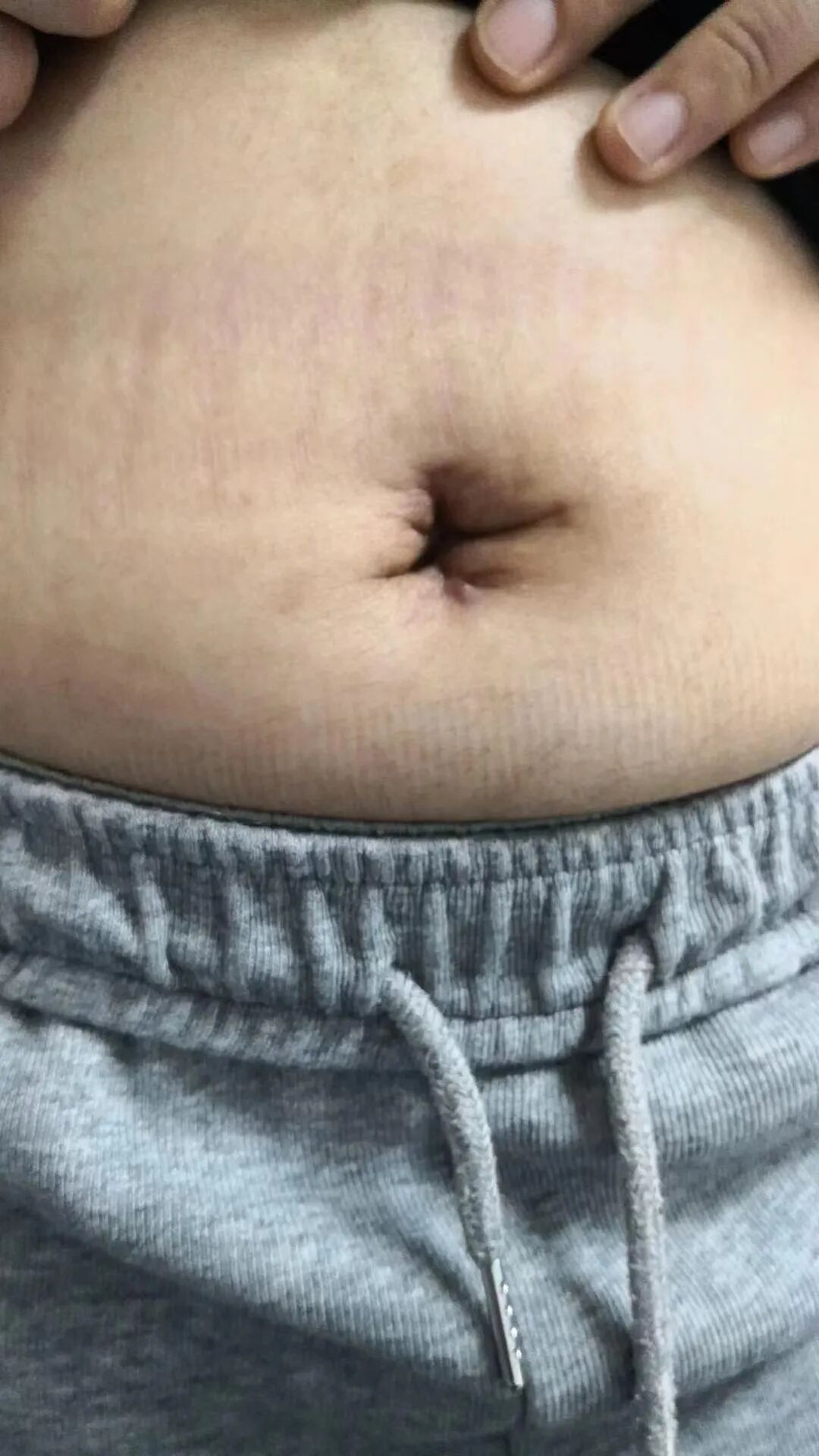 妇科器械盘怎么消毒妇科手术也“医美”_https://www.jmylbn.com_新闻资讯_第27张