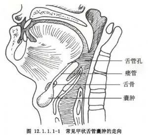 这个典型病例 让你掌握甲状舌骨囊肿 医学之声 微信公众号文章阅读 Wemp