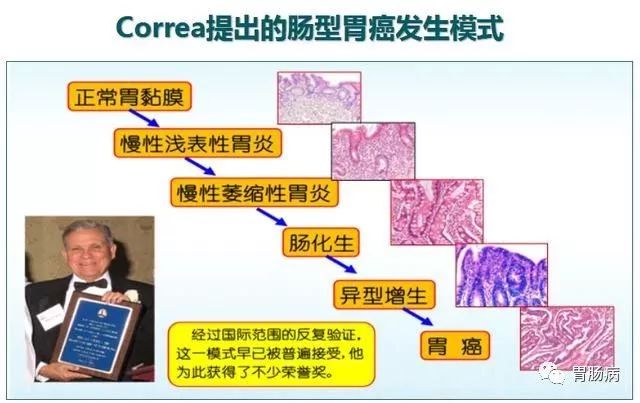 抽血真能篩查胃癌嗎？ 健康 第6張