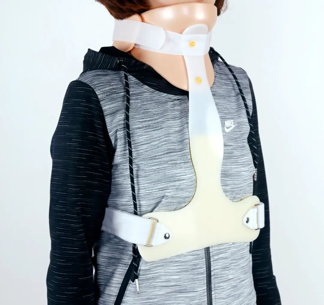 什么是费城颈托脊柱矫形器知识(一)_https://www.jmylbn.com_新闻资讯_第2张