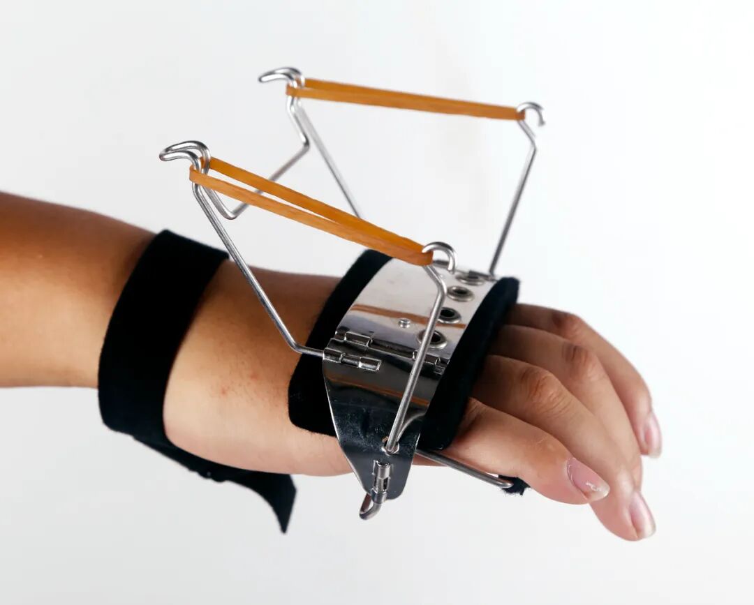 上肢夹板怎么用中风后上肢矫形支具该怎样选择？_https://www.jmylbn.com_新闻资讯_第6张