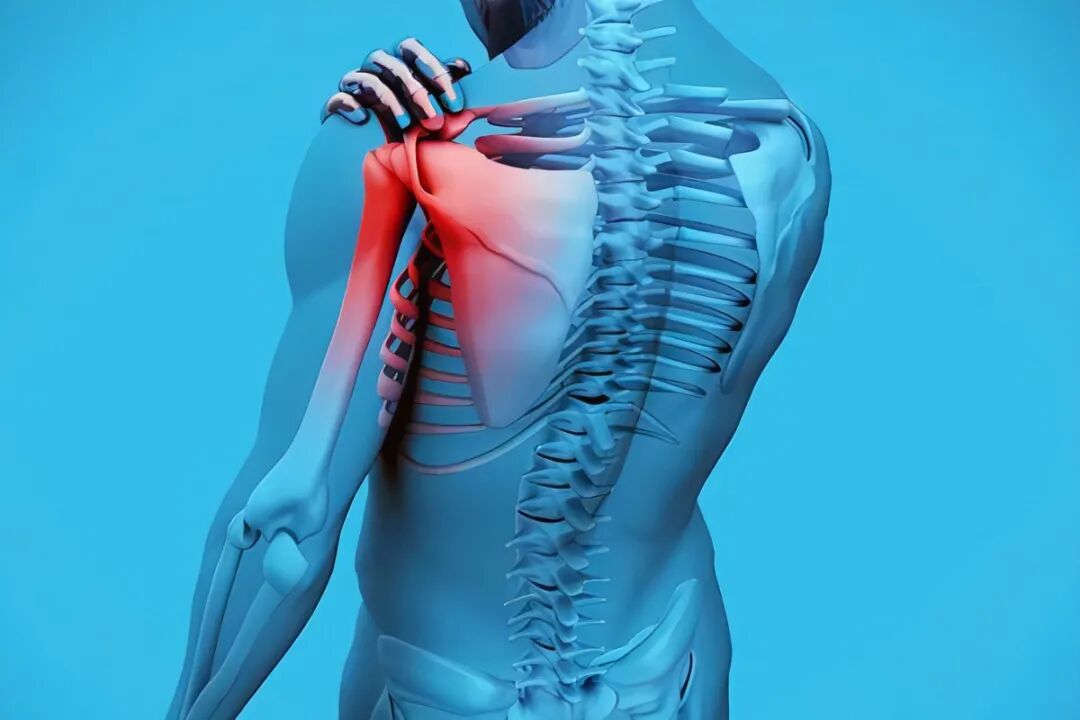 上肢夹板怎么用中风后上肢矫形支具该怎样选择？_https://www.jmylbn.com_新闻资讯_第7张