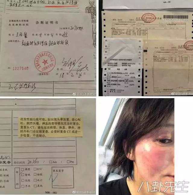 蔣勁夫承認家暴女友並發文道歉，但粉絲的評論卻讓人惡心 娛樂 第22張