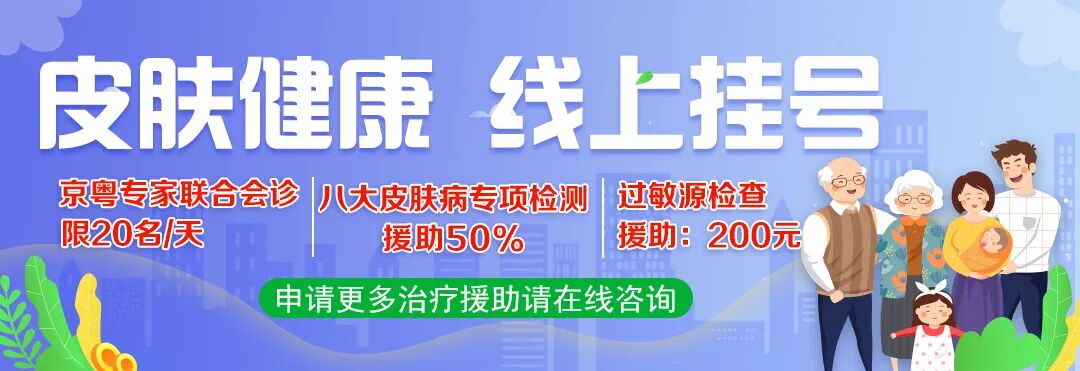 有时候头皮感觉刺痛刺痛的怎么回事？