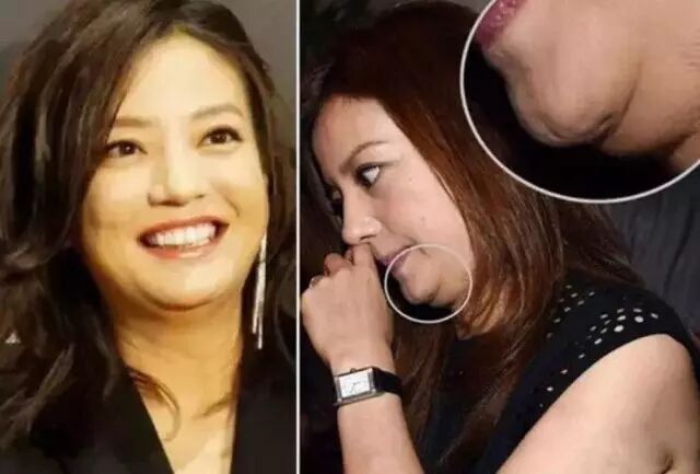 ã€Œå¥³æ˜Ÿé›™ä¸‹å·´ã€çš„åœ–ç‰‡æœå°‹çµæžœ