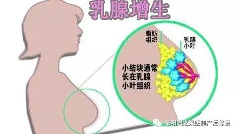 【母婴头条】乳房出现“青筋”还涨疼得厉害？有可能是遇到“乳腺