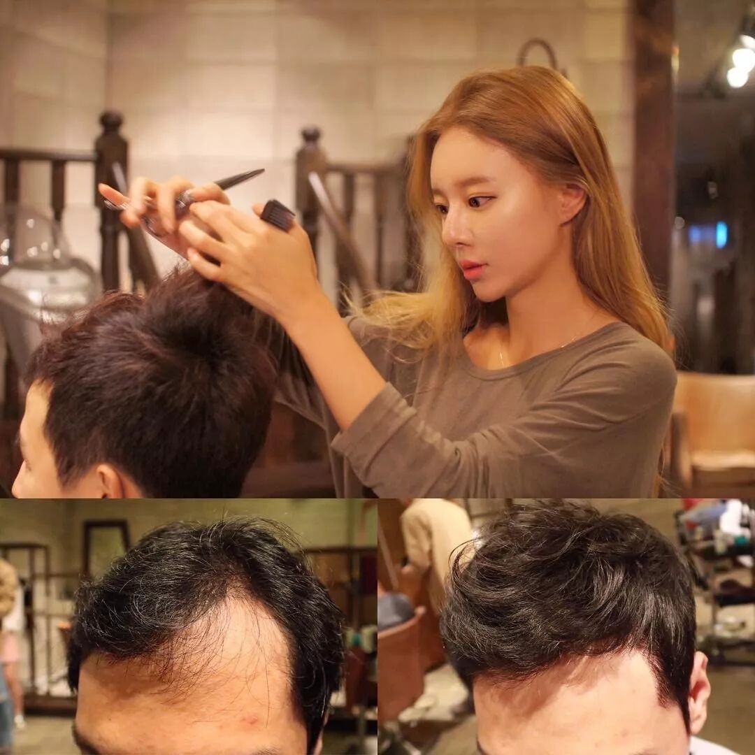 高发际线男生，该如何拯救自己的脑袋？