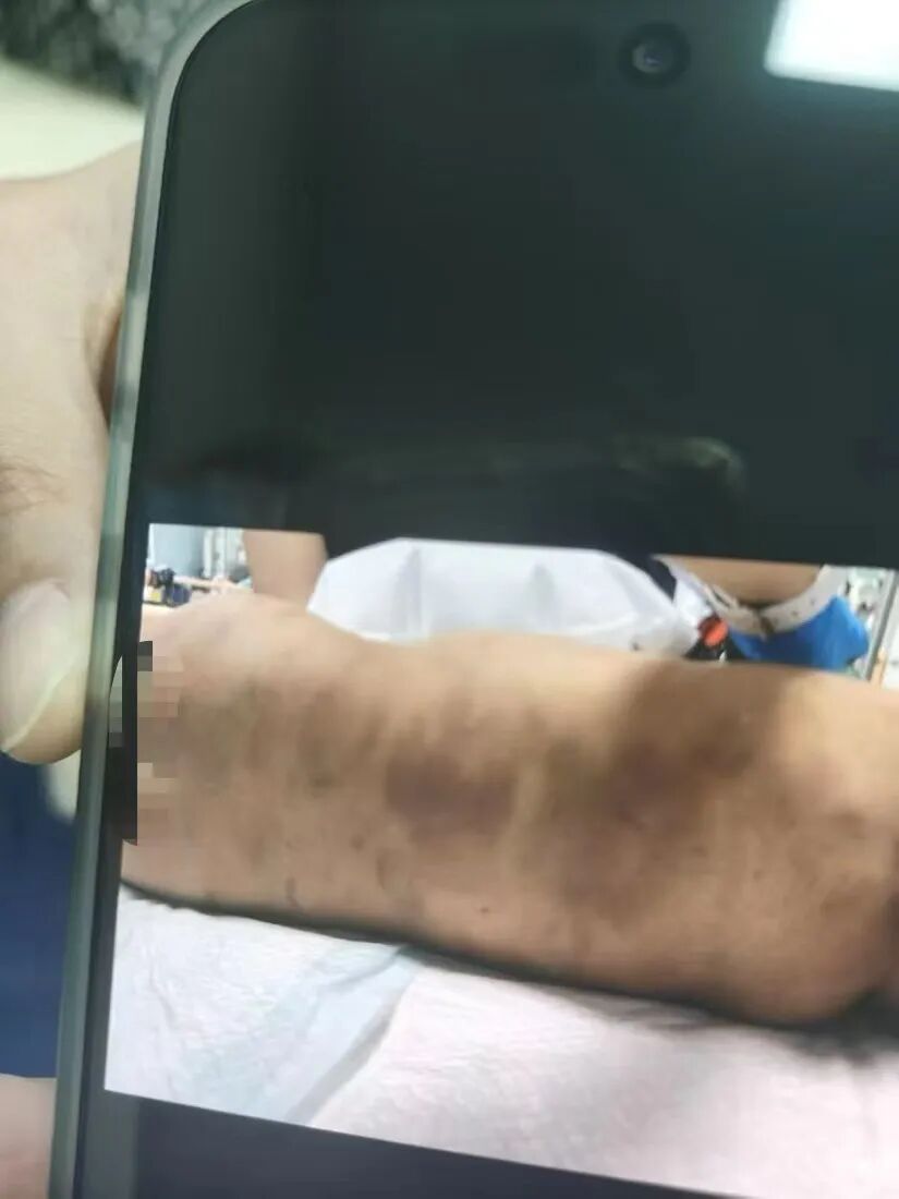 孩子妈妈讲述男童受虐致死案细节，生父希望大事化小