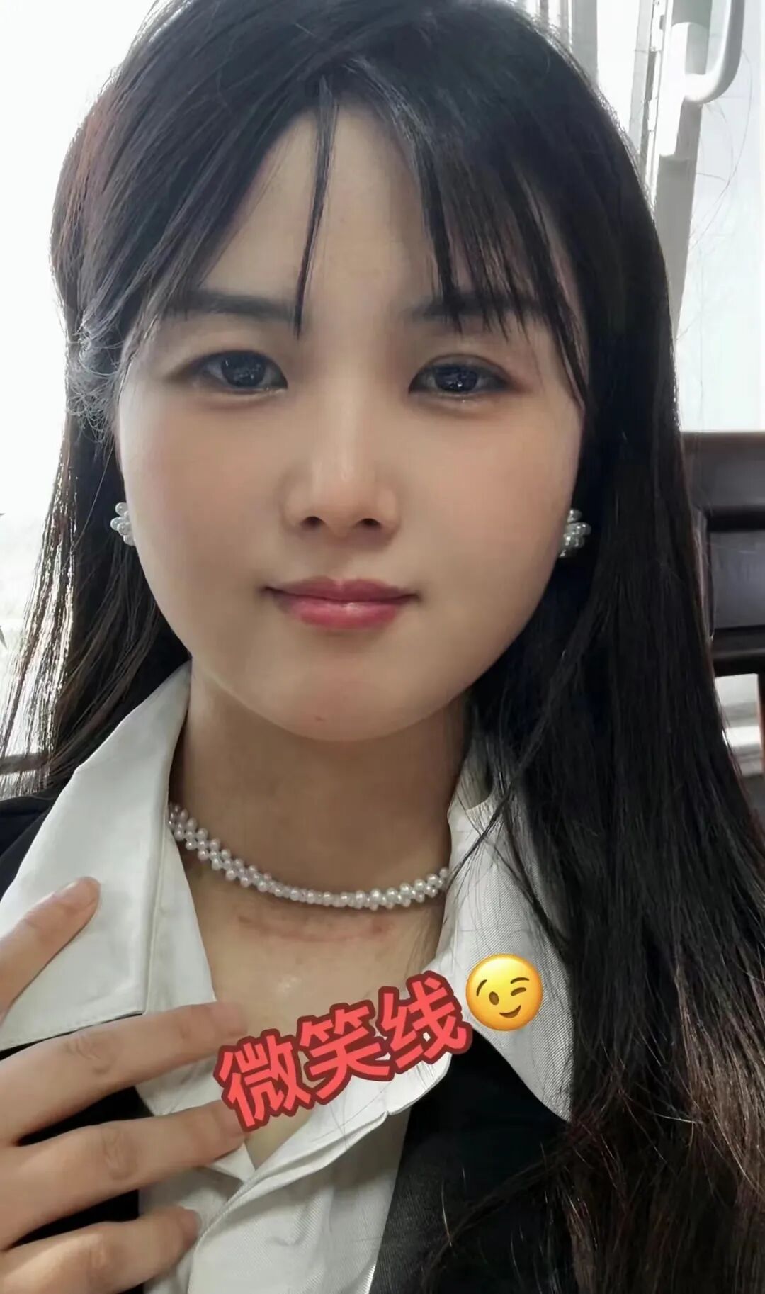 千万粉丝网红“一笑倾城”自曝患癌，警惕：发病率逐年上涨