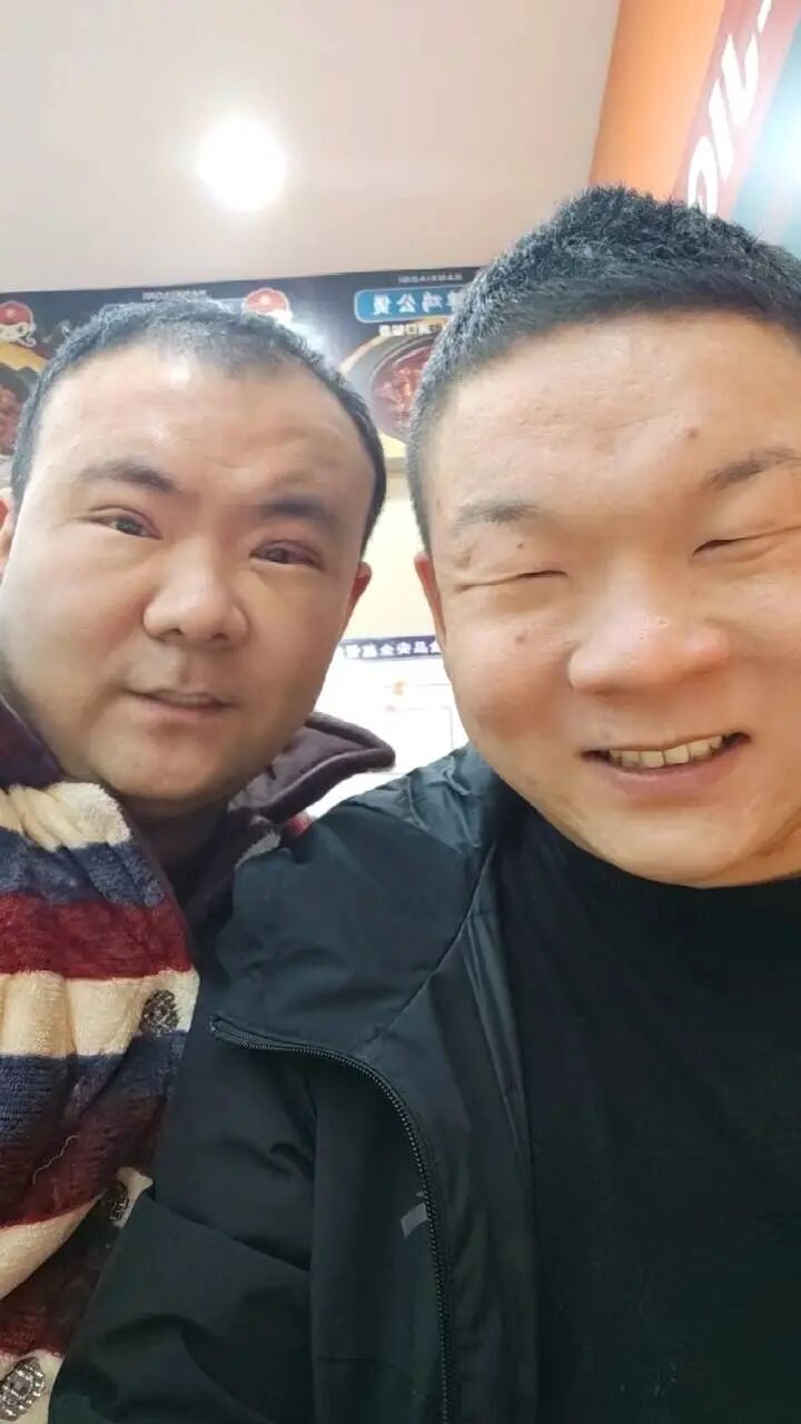 手术台怎么调41岁男子陪弟弟割双眼皮，自己却上了手术台，当事人：都是眯眯眼曾被人调侃，现在自信多了_https://www.jmylbn.com_新闻资讯_第3张