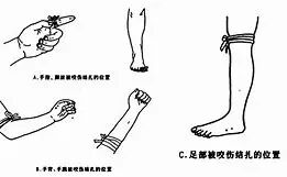 动物门诊用什么x光机普安县人民医院动物咬伤门诊正式开诊啦~_https://www.jmylbn.com_新闻资讯_第7张