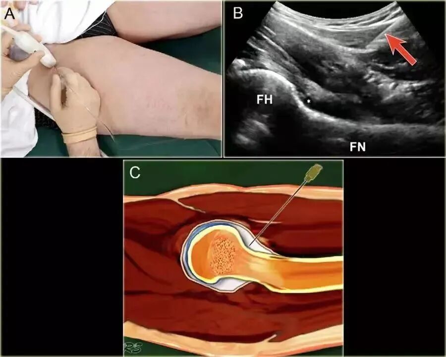 口腔无痛麻醉仪怎么用好消息！普安县人民医院麻醉、疼痛门诊开诊啦~_https://www.jmylbn.com_新闻资讯_第6张