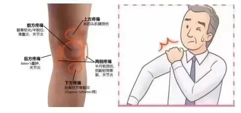 口腔无痛麻醉仪怎么用好消息！普安县人民医院麻醉、疼痛门诊开诊啦~_https://www.jmylbn.com_新闻资讯_第3张