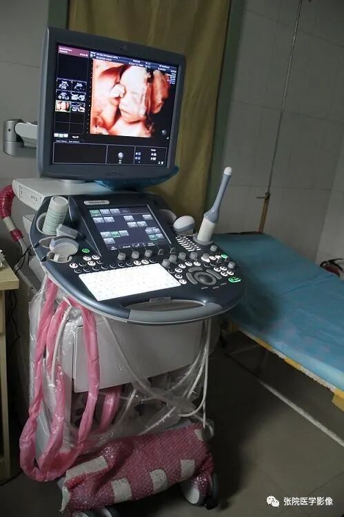 ct为什么需要预热机器医学影像器械使用（ct，超声诊断仪）_https://www.jmylbn.com_新闻资讯_第11张