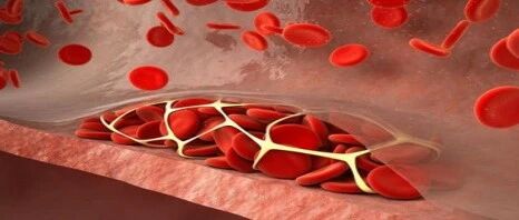 关于血脂的11问11答，你想知道的都在这里！
