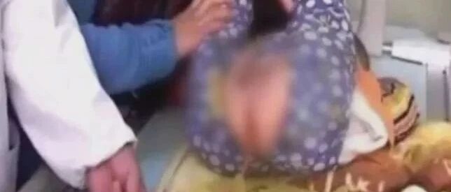 半岁孩子肾衰竭，这种给孩子退烧的方法要慎用！