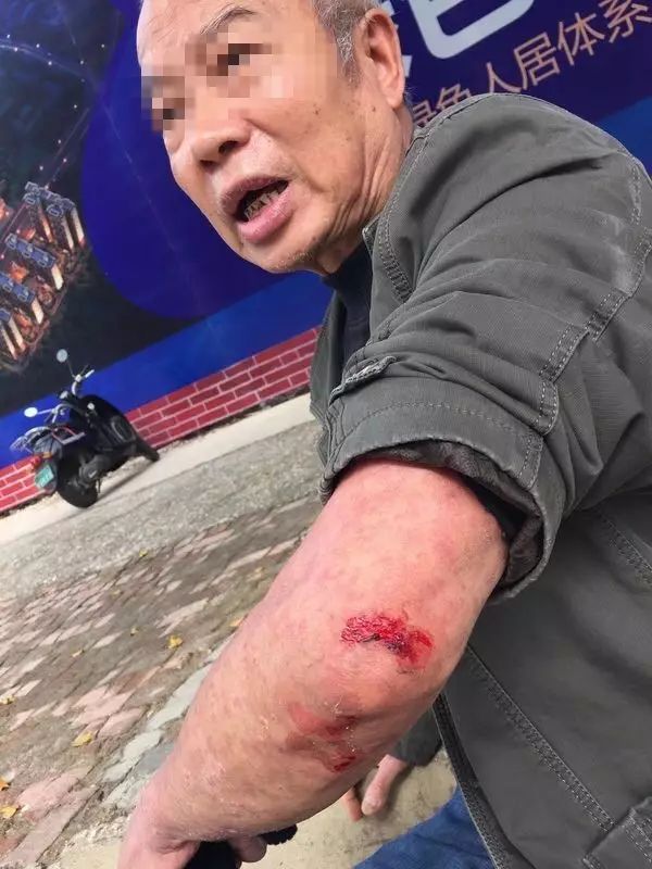 "电驴"撞倒老人后跑了?南宁警方正全城追查肇事车辆!