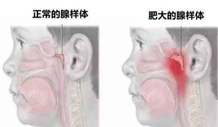 快檢查！這個睡眠狀況可能讓娃變笨、變醜，現在重視還不晚 親子 第11張