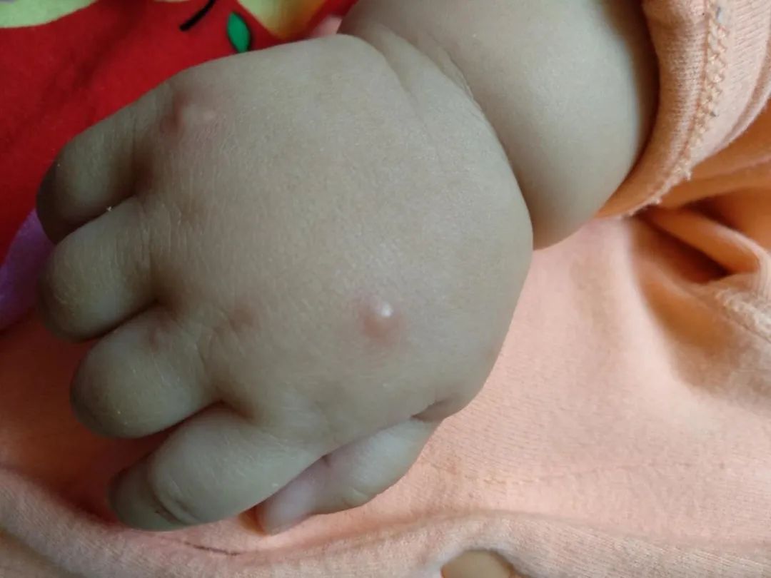 電蚊香、驅蚊液、驅蚊手環…能給寶寶用嗎？可能你一直都選錯了！ 親子 第6張