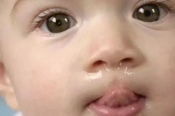 寶寶流鼻涕≠感冒，發現這種鼻涕要特別當心！ 親子 第3張