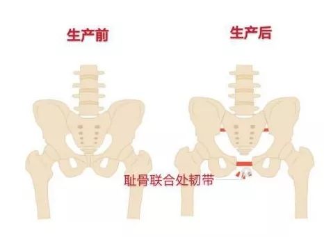 別瞎做 ！ 這些最坑中國女人的「產後保養」項目，白花錢還可能對身體有害！ 親子 第5張