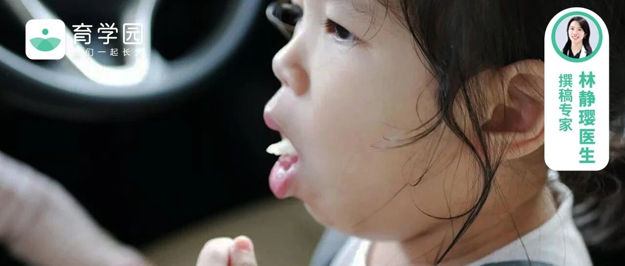 又一例！春节聚餐，警惕孩子异物呛噎！医生教你正确应对（附演示视频）