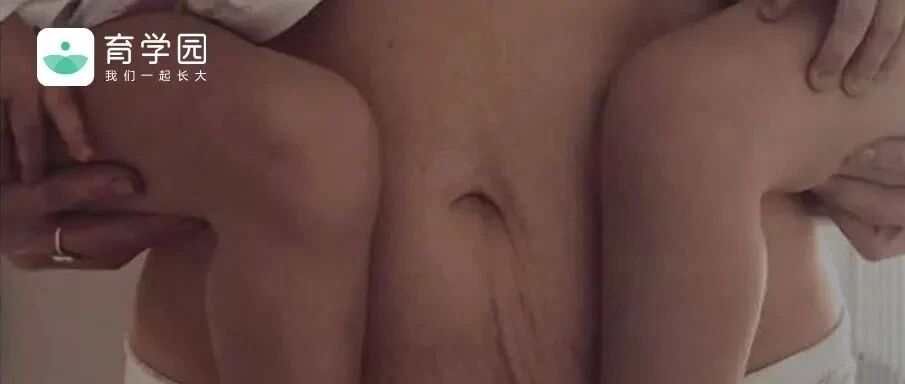 怀孕身材走样被群嘲：他们凭什么指责一个妈妈？