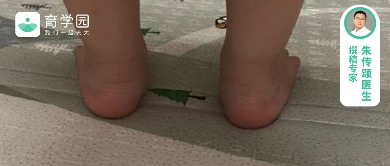 快看看孩子鞋底，有这种形状，小心足外翻！