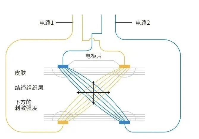 中频为什么能镇痛深度理疗，精准镇痛——郯城中心医院中频干扰电疗法_https://www.jmylbn.com_新闻资讯_第3张