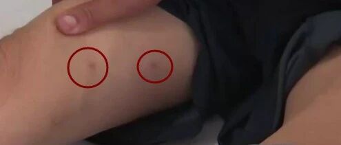 辽宁人注意！20多人接连中招，4人不幸身亡！都因为这个"小东西"