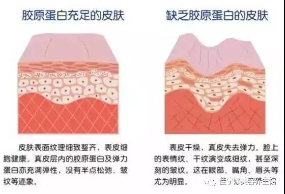 无创仪器是什么高科技美容时代——原装意大利进口贝嘉文系列仪器！_https://www.jmylbn.com_新闻资讯_第7张