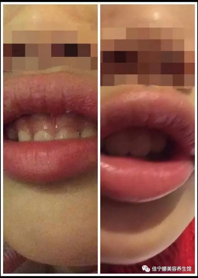 无创仪器是什么高科技美容时代——原装意大利进口贝嘉文系列仪器！_https://www.jmylbn.com_新闻资讯_第9张