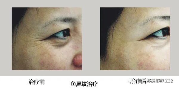 无创仪器是什么高科技美容时代——原装意大利进口贝嘉文系列仪器！_https://www.jmylbn.com_新闻资讯_第8张