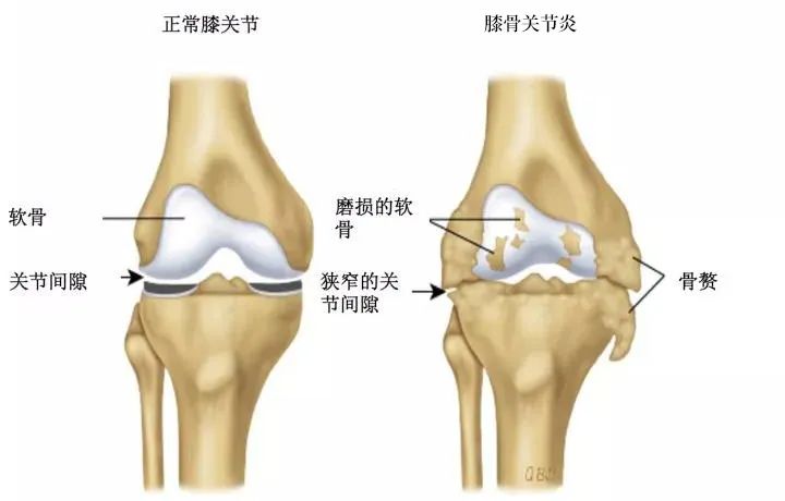 大腿骨正常图片图片