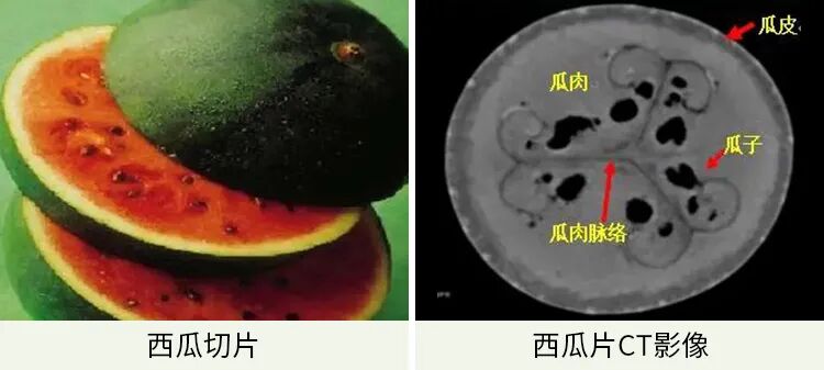 一片片扫描,能够得到各个平面的西瓜纹理,可以帮我们立体观察内部结构