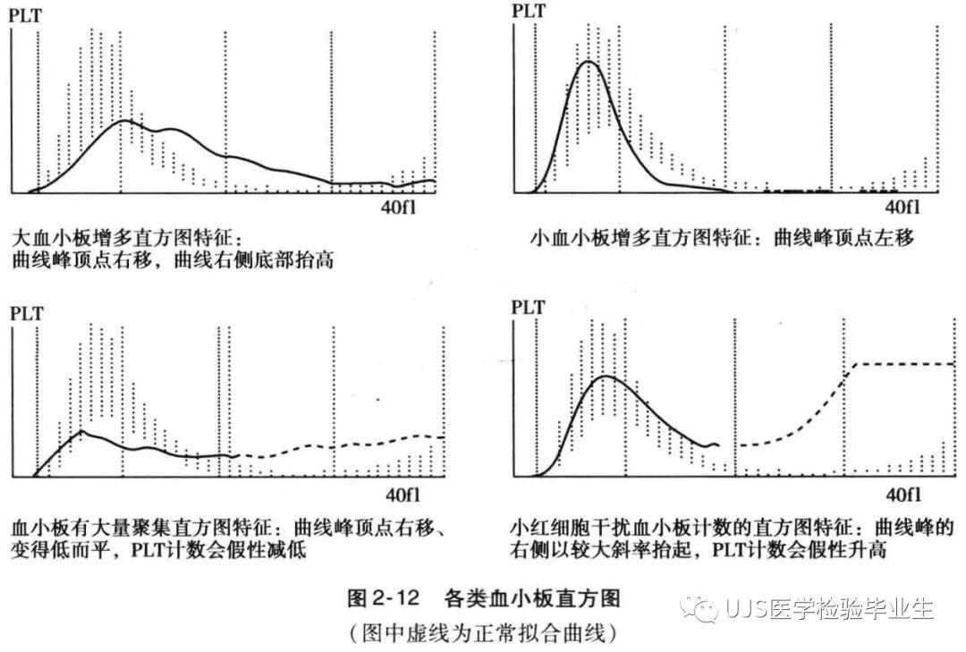 rbc直方图怎么看【小结】常见血细胞分析仪的检测原理与直方图／散点图_https://www.jmylbn.com_新闻资讯_第9张