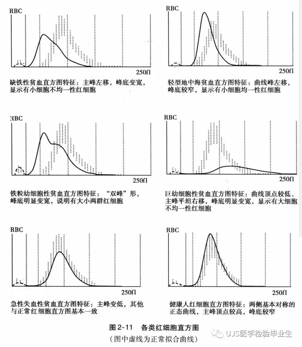 rbc直方图怎么看【小结】常见血细胞分析仪的检测原理与直方图／散点图_https://www.jmylbn.com_新闻资讯_第5张