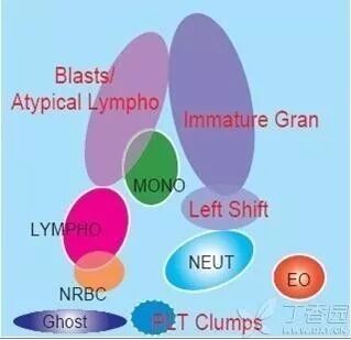 rbc直方图怎么看【小结】常见血细胞分析仪的检测原理与直方图／散点图_https://www.jmylbn.com_新闻资讯_第18张